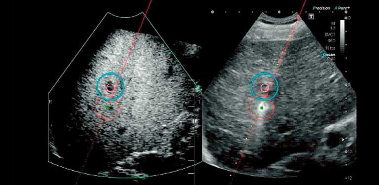 Princípios da ultrassonografia