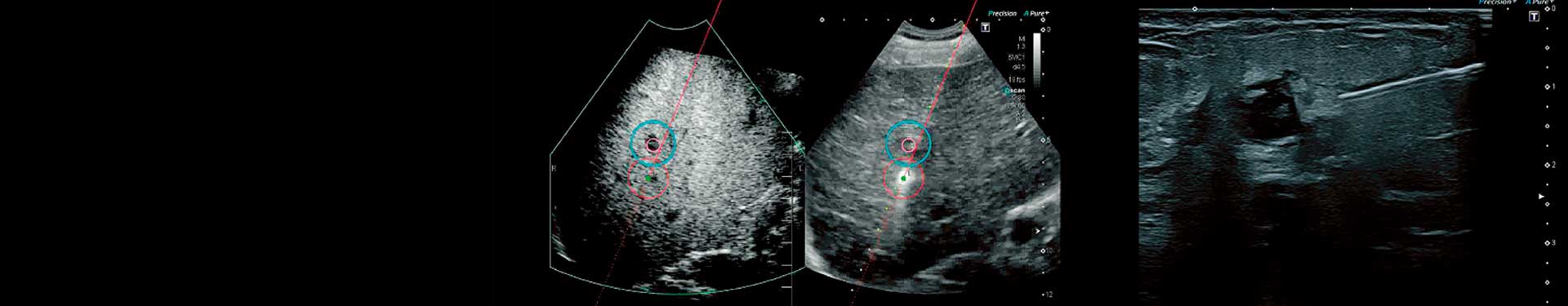 Princípios da ultrassonografia